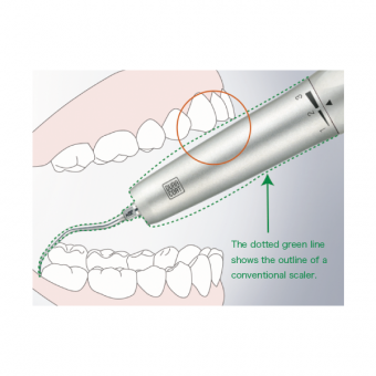 Ti-Max S970 - пневматический скалер (для переходника NSK)